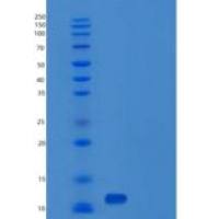 小鼠囊泡关联膜蛋白2(VAMP2)重组蛋白