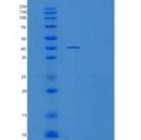 人泛素结合酶E2 D1重组蛋白