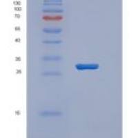 人含V-Set域T-细胞激活抑制因子1(VTCN1)重组蛋白