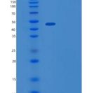人YY1转录因子(YY1)重组蛋白