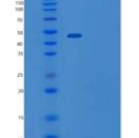 人YY1转录因子(YY1)重组蛋白
