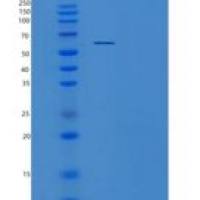 人ZNF689重组蛋白
