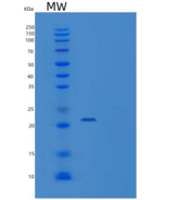 人VPS25重组蛋白