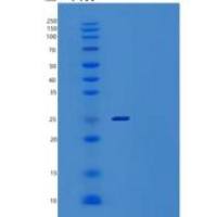 人VTI1B重组蛋白