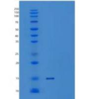 人血管内皮生长因子121(VEGF121)重组蛋白