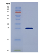 人血管内皮生长因子B(VEGFB)重组蛋白