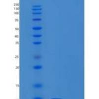 人XAGE1A重组蛋白
