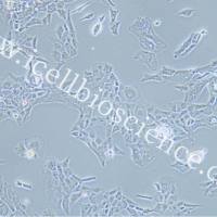 MUG-Chor1 人骶骨脊索瘤细胞/DLD-1/DMS 114