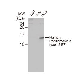 Human Papillomavirus type 18 E7 antibody [HL2522] (GTX638883)