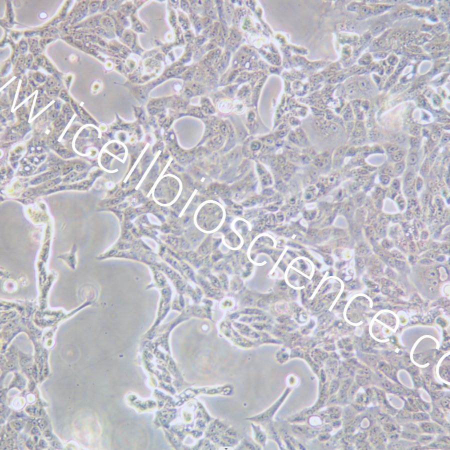CFPAC-1 人胰腺癌细胞  STR鉴定