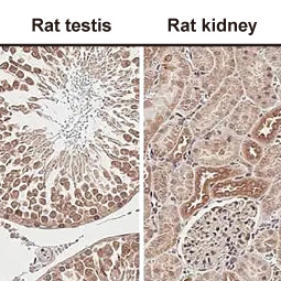 GnRHR antibody [HL2638] (GTX639094)