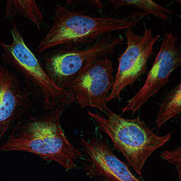 Vimentin antibody [HL1506] (GTX636980)