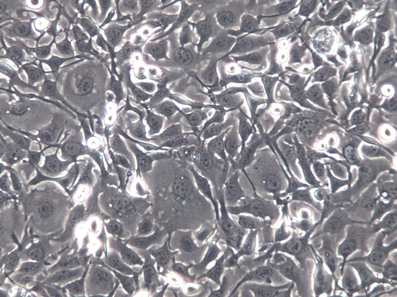 【STR鉴定】KYSE-410、KYSE-410细胞、KYS