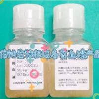 新生牛血清(无菌)