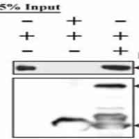 蛋白质体外结合实验（GST pull-down 技术）