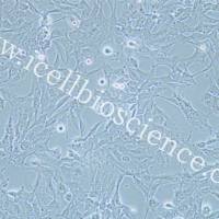 KHM-5M 人甲状腺癌细胞/STR鉴定