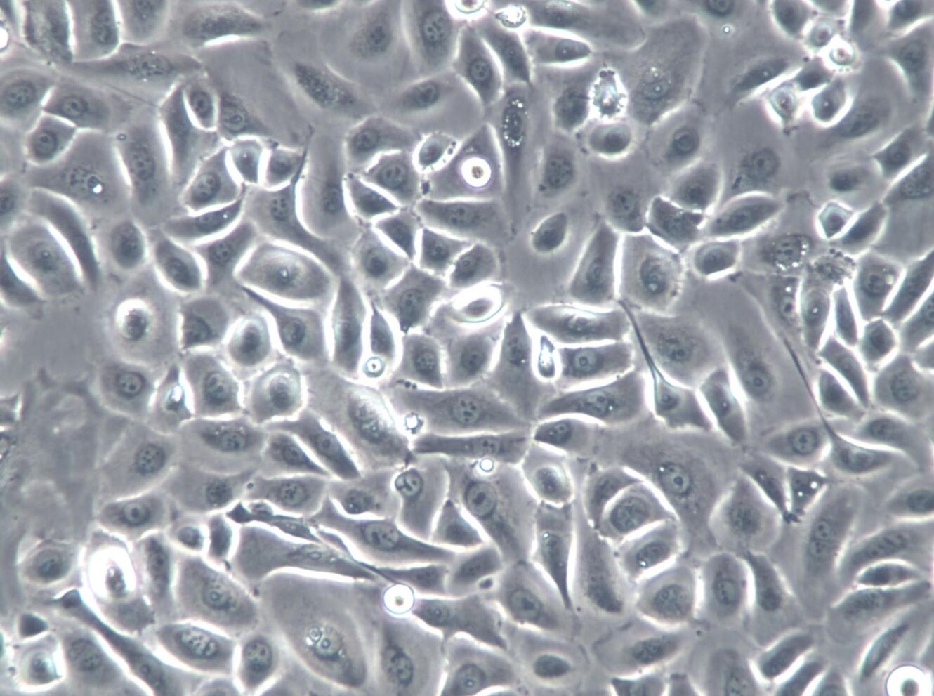 【STR鉴定】RWPE-2、RWPE-2细胞、RWPE-2前