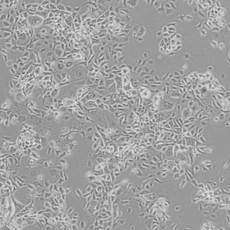 COR-L23_人非小细胞肺癌细胞