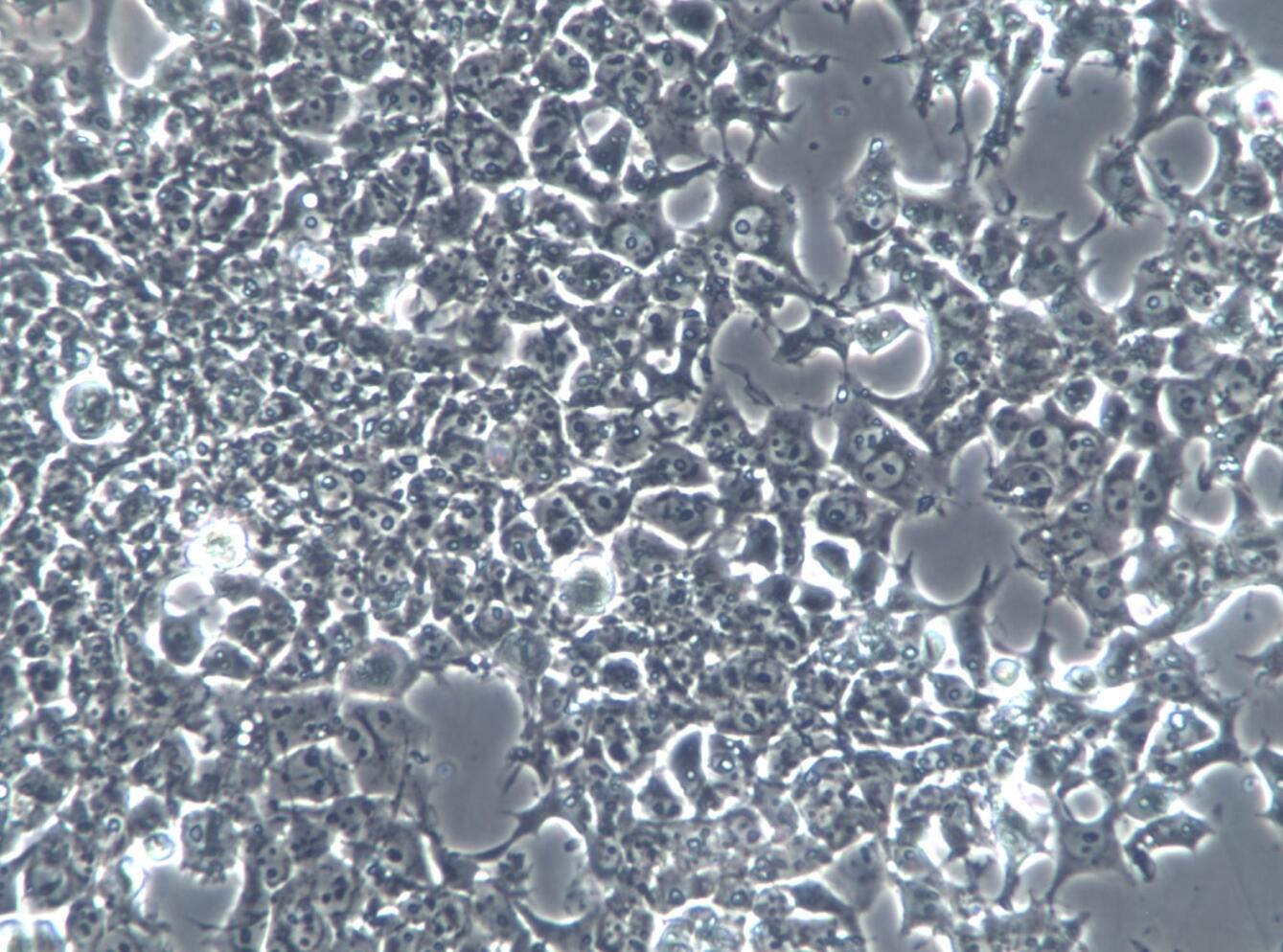 【STR鉴定】NCCIT、NCCIT细胞、NCCIT畸胎癌细