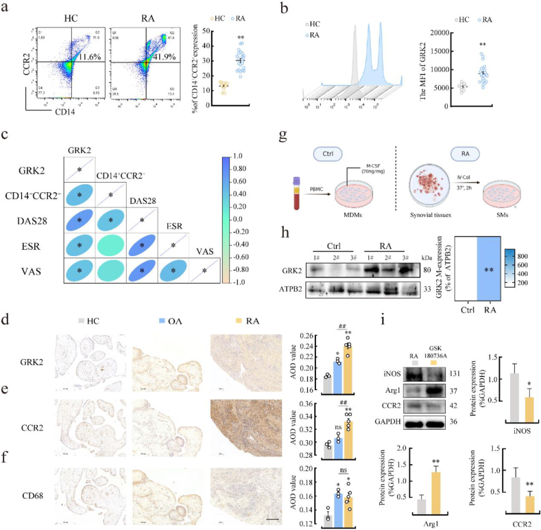LabEx多因子检测平台助力类风湿性关节炎研究