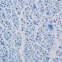 甲苯胺蓝染色实验