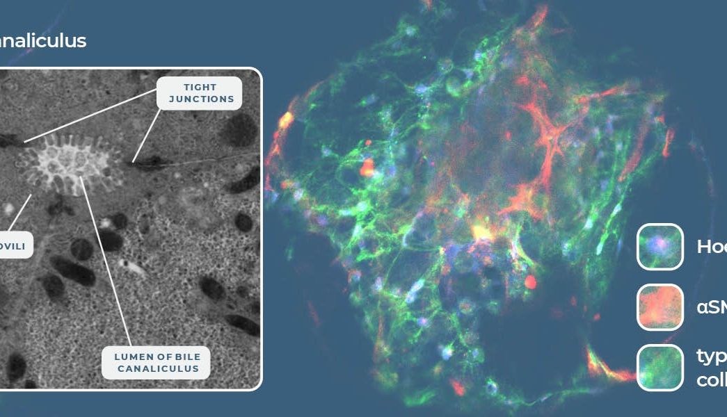 通过器官芯片的预测能力降低药物性肝损伤的风险_曼博生物
