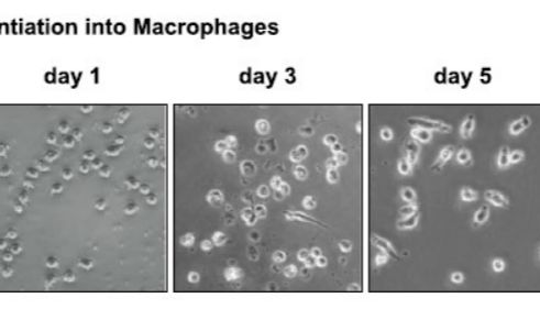【干货分享】如何诱导巨噬细胞极化