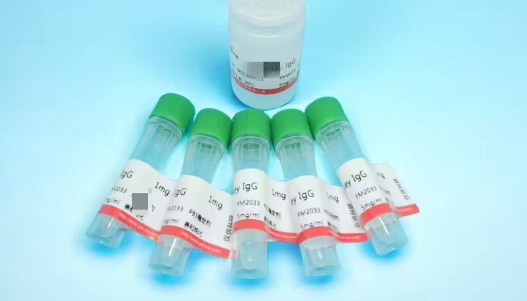 Western blot检测的抗体怎么选择合适的？