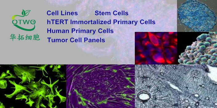 Farage人B淋巴瘤细胞|Farage细胞|人B淋巴瘤细胞