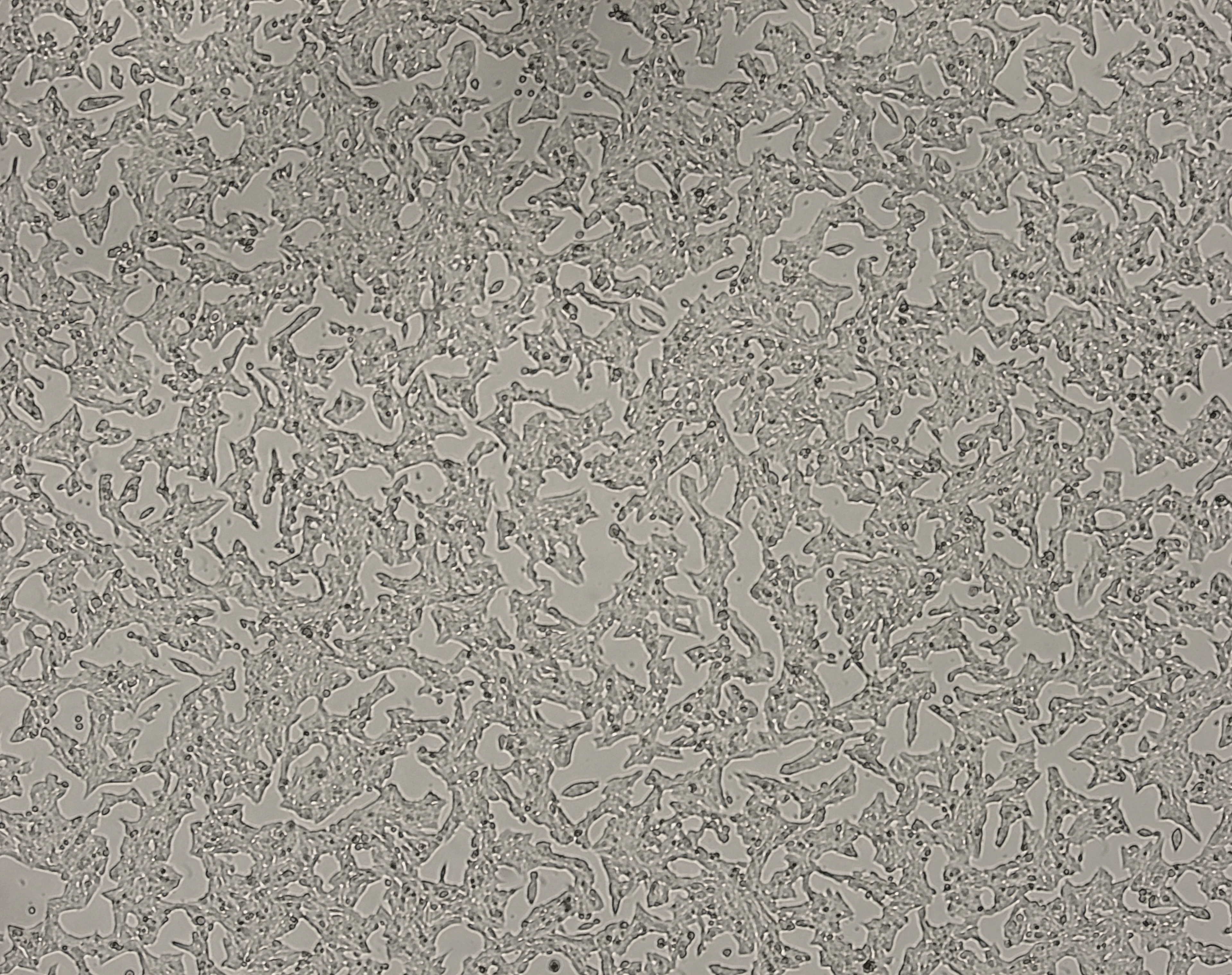 细胞攻略 | INS-1(大鼠胰岛细胞瘤细胞)培养教程