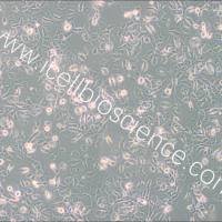 SUM149PT 人乳腺癌细胞/STR鉴定