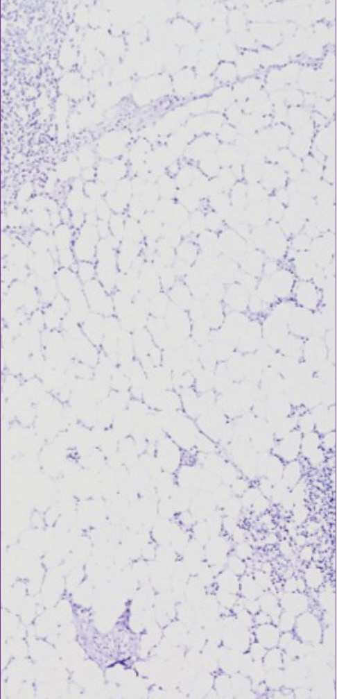 VectaPlex™ Antibody Removal Kit  ——简化您的多重免疫荧光(mIHC)染色