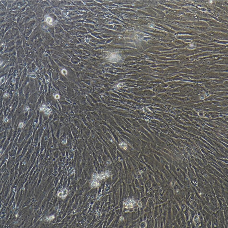 小鼠胰腺星状细胞/免疫荧光鉴定