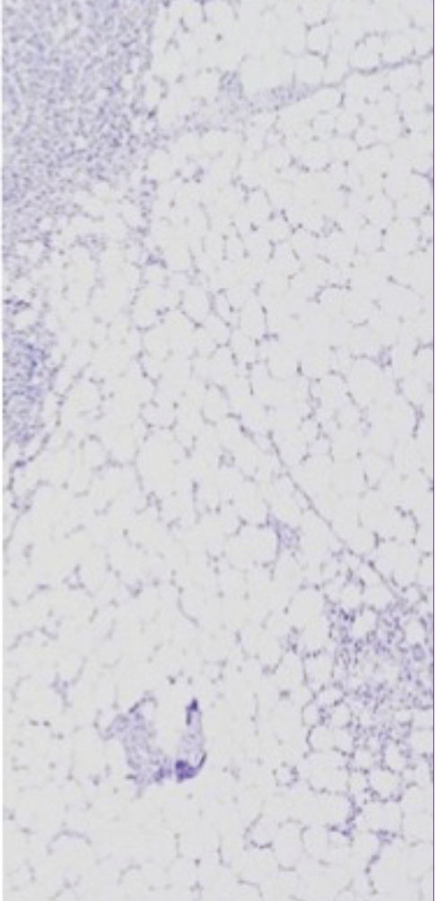 VectaPlex™ Antibody Removal Kit  ——简化您的多重免疫荧光(mIHC)染色