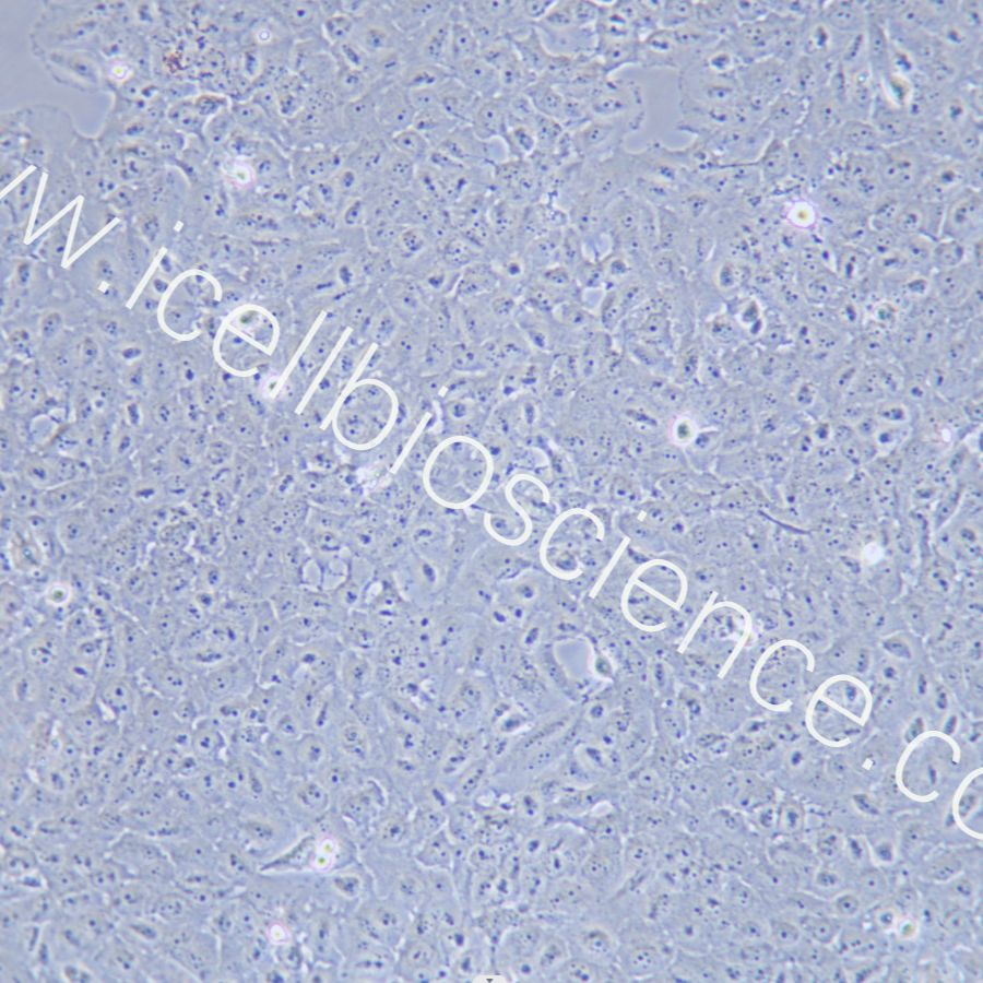 OVCAR-8/ADR 人卵巢癌腺癌阿霉素耐药细胞