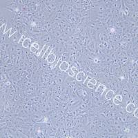 OVCAR-8/ADR 人卵巢癌腺癌阿霉素耐药细胞