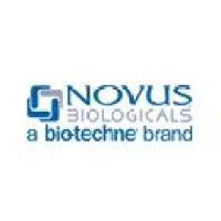 Rabbit Polyclonal ODF4 Antibody