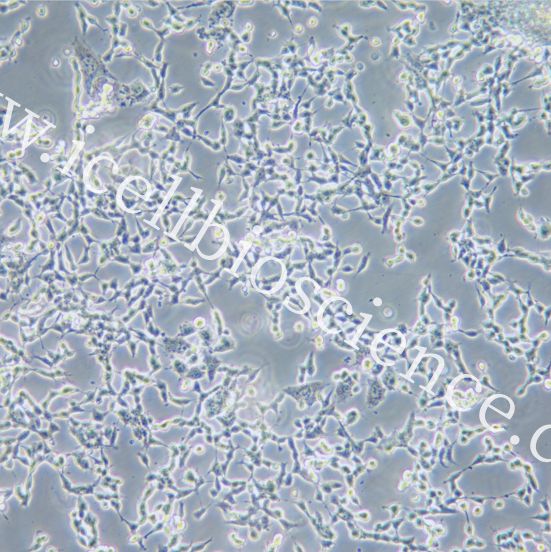 IMR-32 人神经母细胞瘤细胞  STR鉴定