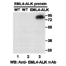 EML4-ALK
