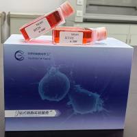 NCI-H660 | NCI-H660细胞 | 人神经内分泌前列腺癌细胞 | STR鉴定