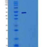 人B7-H3/CD276(C-6His)重组蛋白