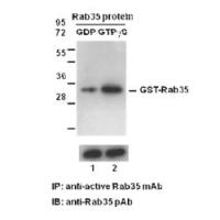 Rab35-GTP 