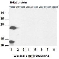 B-Raf (V600E)