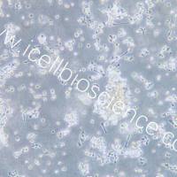 OCI-LY3、OCI-LY3细胞、OCILY3细胞、OCILY3、人弥漫大B细胞淋巴瘤细胞/STR鉴定