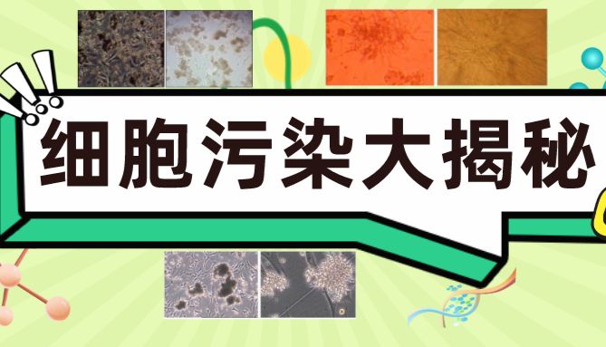 超详细版|细胞污染类型与原因大揭秘！附补救方法