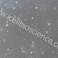 结直肠癌相关成纤维细胞/免疫荧光鉴定