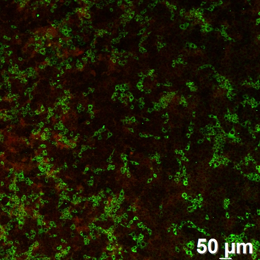 传染性胃肠炎TGE单抗，纯化IgG  M蛋白