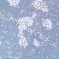 NCI-H146/NCI-H146细胞/人小细胞肺癌细胞/STR鉴定/镜像绮点（Cellverse）