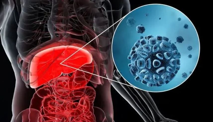 【全新】丙肝HCV 嵌合抗原-使用单一抗原即可检测HCV阳性血清