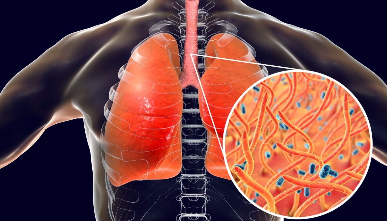 【推荐】60分钟内出结果，FDA获证的百日咳分子检测！